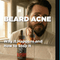 Beard Acne: Why It Happens and How to Stop It