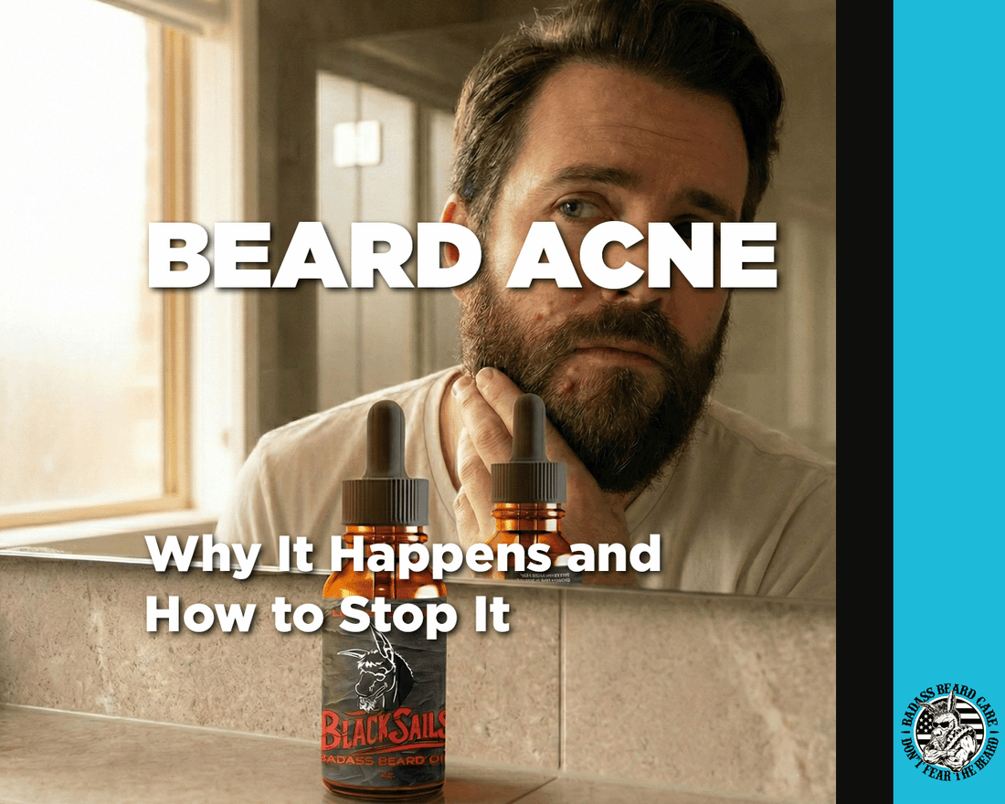 Middle Aged Bearded Man staring in mirror at acne forming around his beard edges on his face